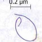 Mikroplastikverschmutzung ist überall, sogar im Atem der Delfine