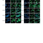 Die Entdeckung neuer Bakterientoxine könnte der Schlüssel zur Bekämpfung von Infektionen sein