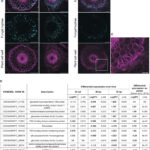 Wissenschaftler betonen den Wettrüsten zwischen Gerste und pathogenen Pilzen